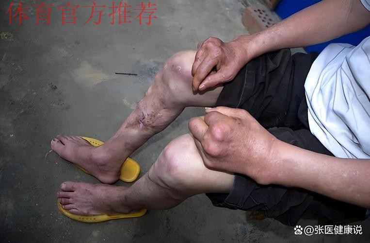 恐怖慎入！24岁加纳中场疑似断腿：小腿90度弯折变形 被担架抬走